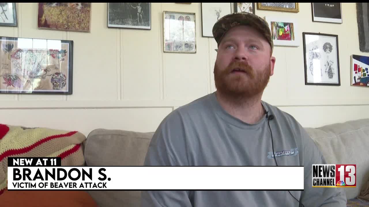 Vermont man attacked by possibly rabid beaver in New York's Lake George, officials warn visitors.