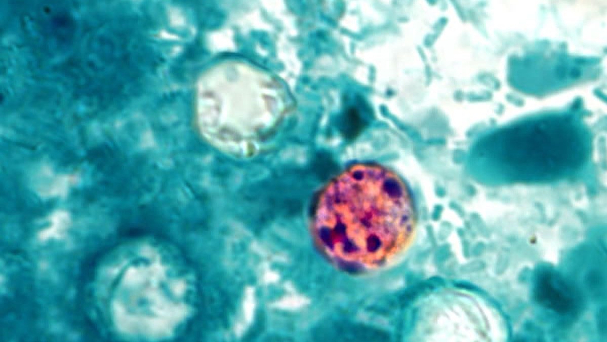 Florida Records 50 Cyclospora Cases Across Over 20 Counties Since May 1, Source Unknown