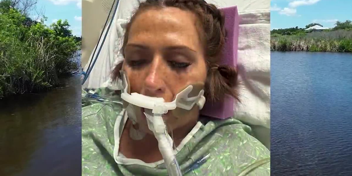 Florida Reports Dozen Flesh-Eating Bacteria Cases; Survivor Urges Caution After Leg Loss