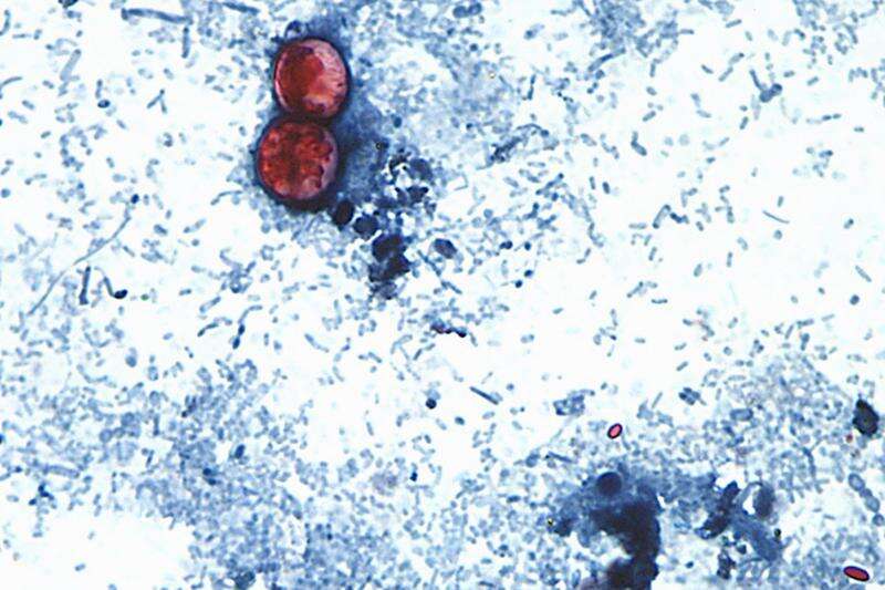 Michigan Reports First Two US Deaths Linked to Widespread Cyclospora Outbreak
