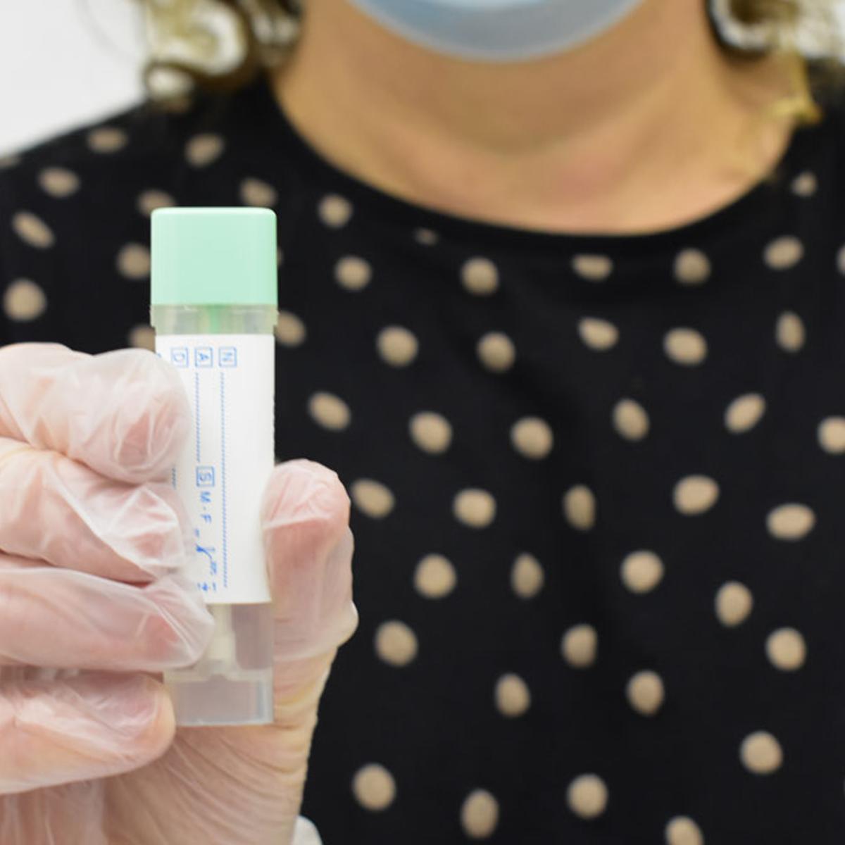 España diagnostica más de 120 casos diarios de cáncer de colon en menores de 50 años