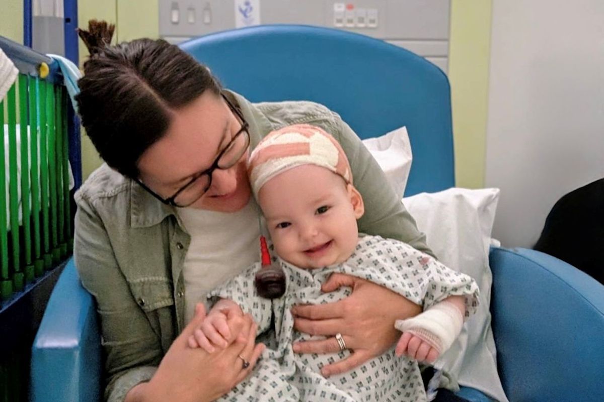 British Toddler Becomes First Patient to Undergo Innovative Skull Surgery Using Springs