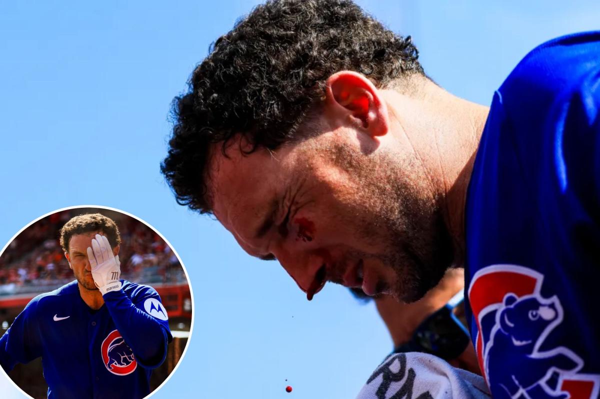 Chicago Cubs Star Alex Bregman Hospitalized After Being Struck By Foul Ball