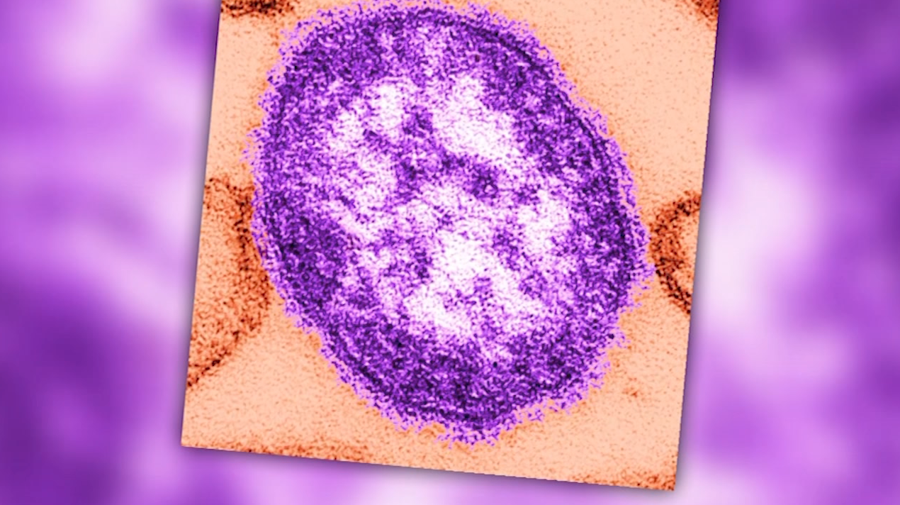 Measles Exposure Alerts Expand to Maryland