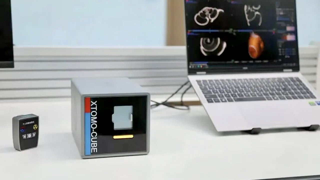 Chinese Researchers Develop the World's Smallest and Lightest 6-Kilogram Portable CT Scanner